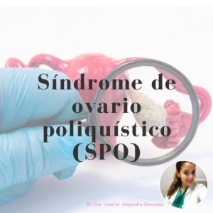Ovario Poliquistico