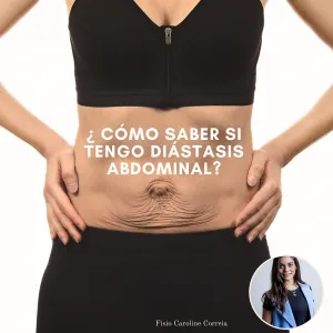 como saber si tengo diastasis abdominal
