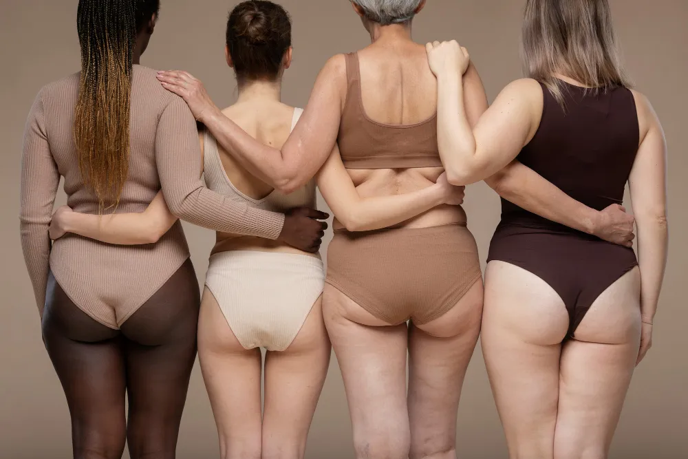 lipedema que es