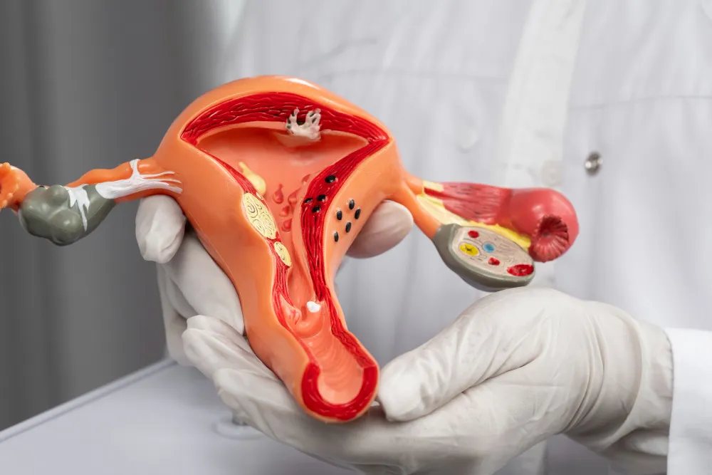 prolapso uterino tratamiento
