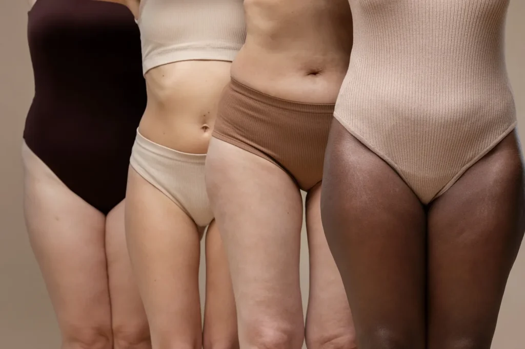la celulitis y la flacidez